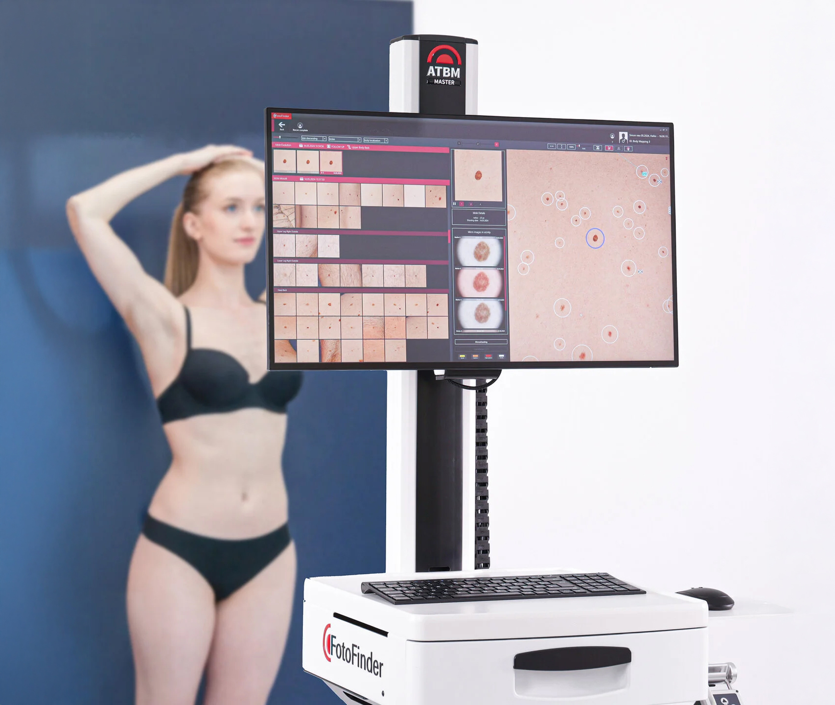 KI-gestützte Hautanalyse KI-gestützte Hautanalyse