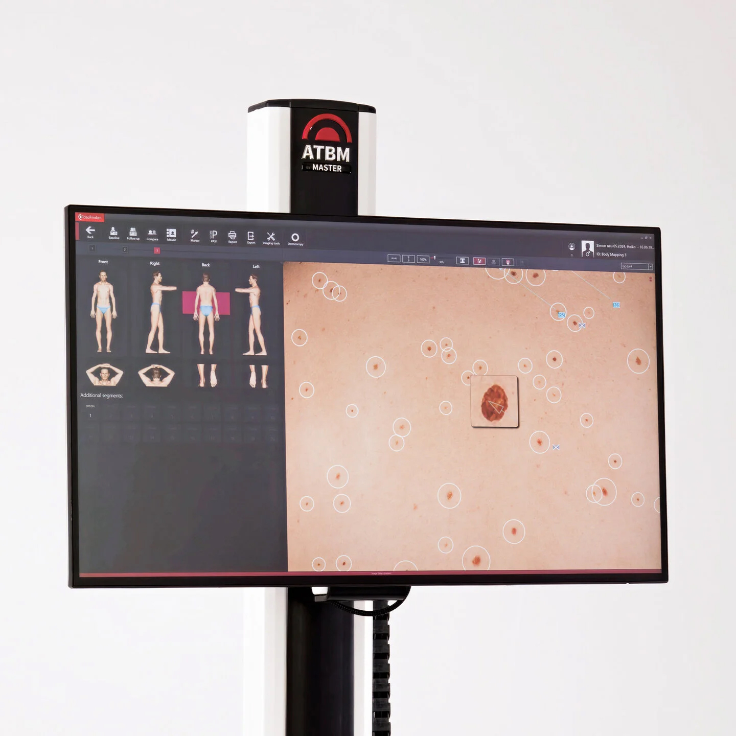 KI-gestützte Hautanalyse KI-gestützte Hautanalyse